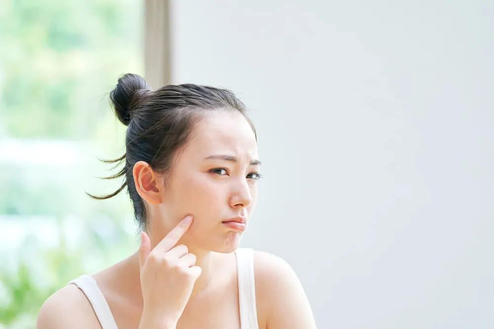 混合肌通常雙頰會容易乾燥